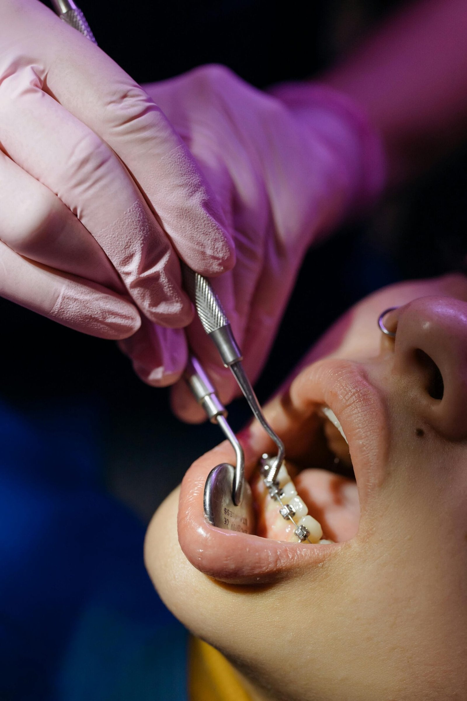 El precio invisible de posponer el dentista