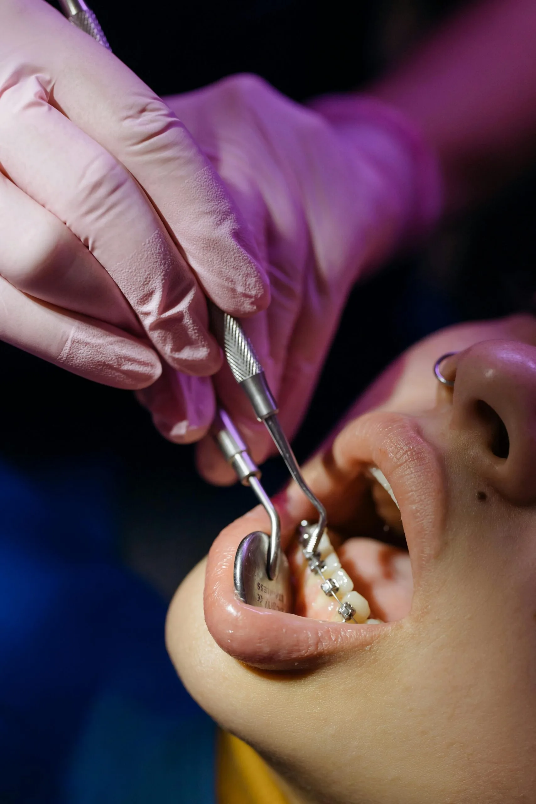 El precio invisible de posponer el dentista